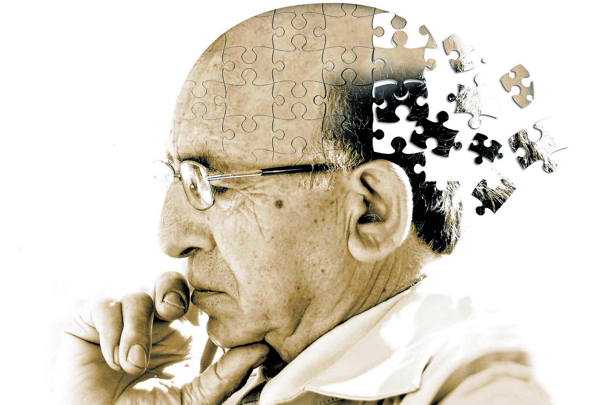 ALZHEIMER’DA YENİ BİR TEDAVİ YÖNTEMİ TMS TEDAVİSİ